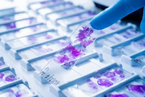 How FFPE Slides Support Pathology and Molecular Analysis