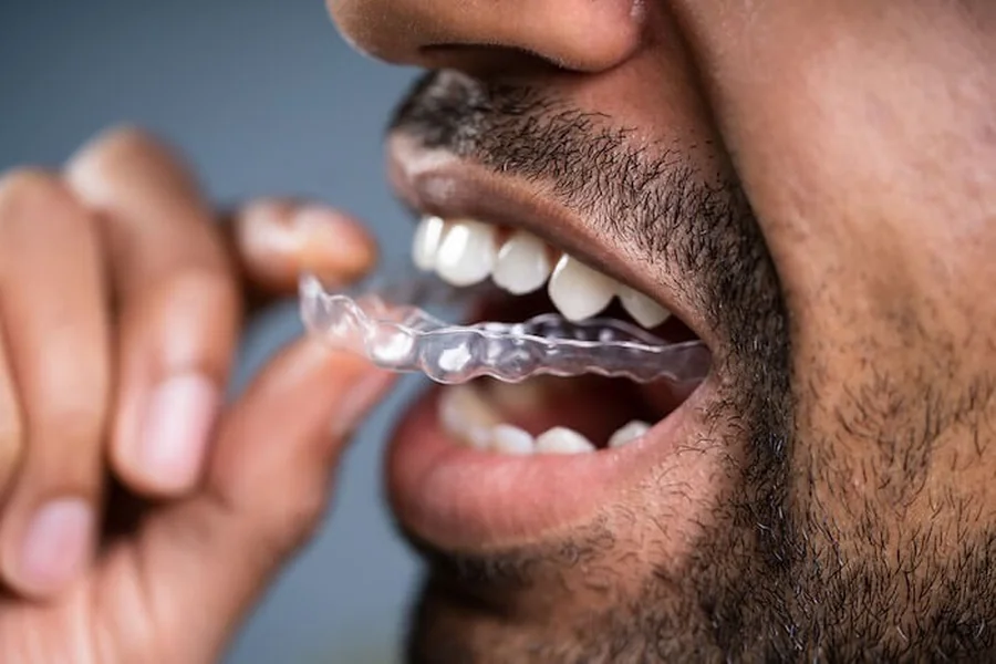 Quality Retainer Sheet What It Looks Like & Why It Matters