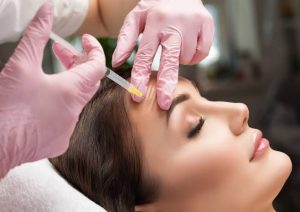 The Benefits of RF Microneedling in Sydney