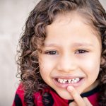How Missing Teeth Impact Your Oral Health